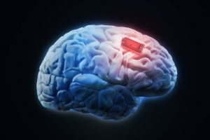 TheMerkle DARPA Brain Implant
